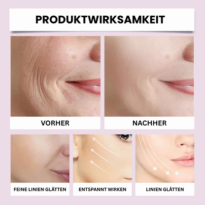 LIFTELLA™ – Dein Gesicht. Nur 10 Jahre jünger